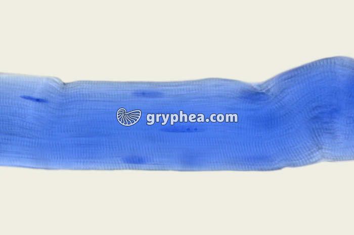 Fibre musculaire colorée au BM x200 - gryphea.com